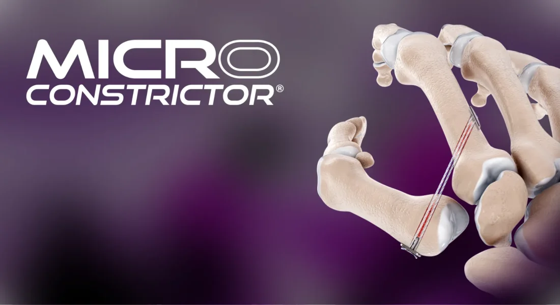 Introducing the Micro Constrictor<sup>®</sup> Image