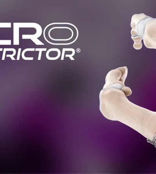 Introducing the Micro Constrictor® Image