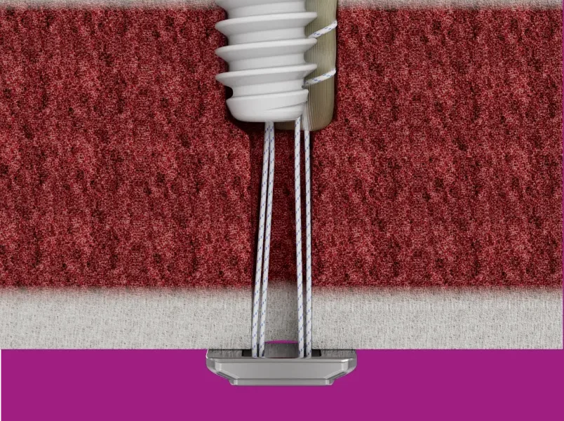 Annual Meeting of the AAOS in Las Vegas Image